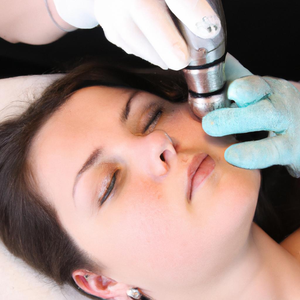 Person receiving microdermabrasion treatment